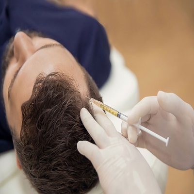 PRP Hair Treatment in Dubai