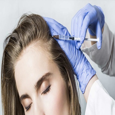 PRP Hair Treatment in Dubai