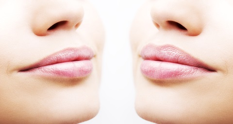 Lip Fillers Before and After