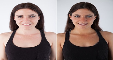 Skin Whitening before and after