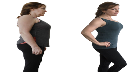 Weight Loss Injections before and after