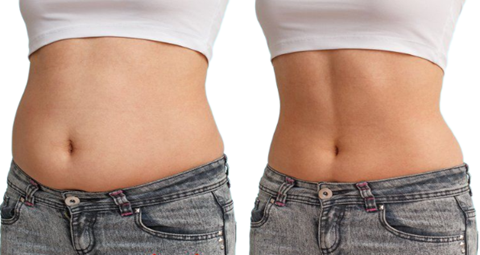 Fat melting before and after