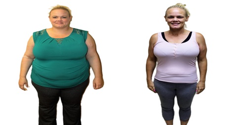 Mounjaro Before and After