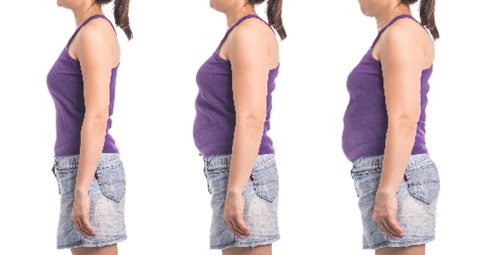 Mounjaro Before and After