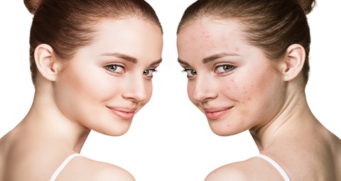 Skin care before and after