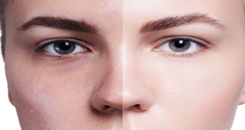 Skin care before and after