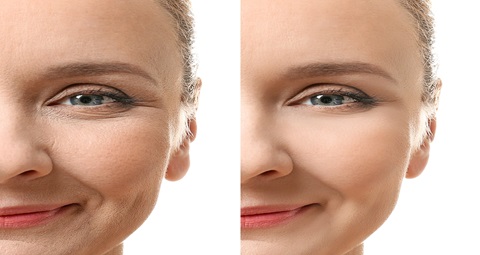 Skin care before and after