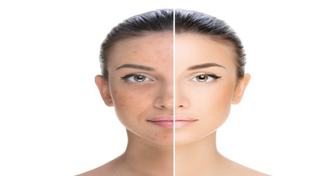 Skin Whitening before and after