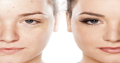 Skin care before and after