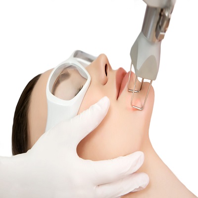 Fractional Laser CO2 in Dubai