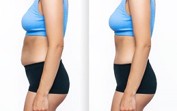 Fat Melting Injections before and after