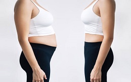 Fat Melting Injections before and after