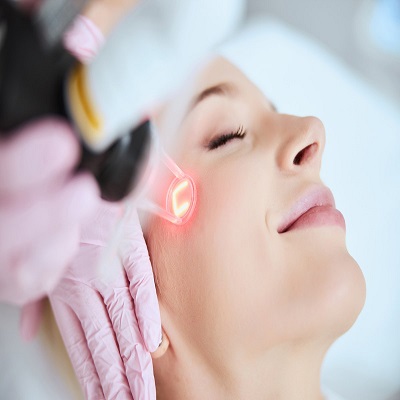 Fractional Laser CO2 in Dubai