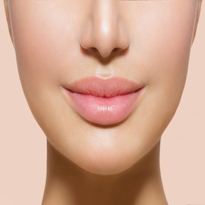 Russian Lip Fillers in Dubai