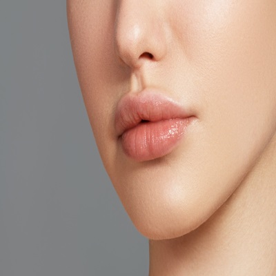 Russian Lip Fillers in Dubai