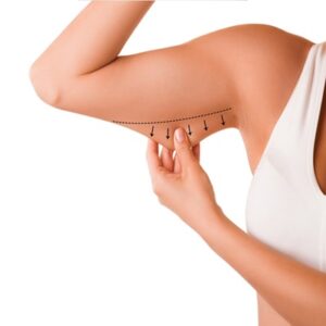 Arm lift surgery Cost in Dubai