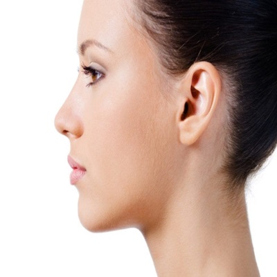 Chin Liposuction in Dubai