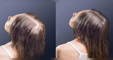 GFC Hair Treatment before and after