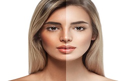 Skin Whitening before and after