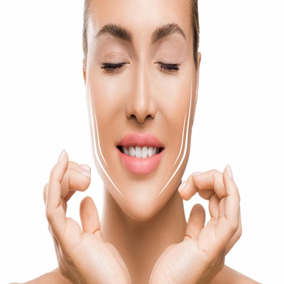 Vector Facelift Treatment