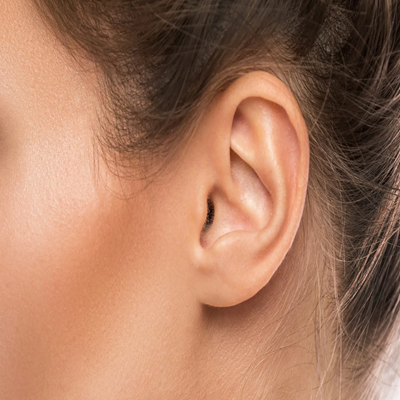 Earlobe surgery in Dubai