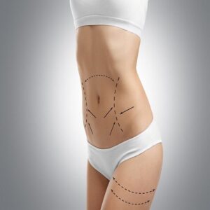 Body Liposuction Cost in Dubai