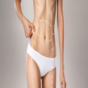 HD Liposuction Cost in Dubai