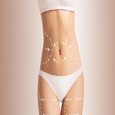 High-Definition Liposculpture in Dubai