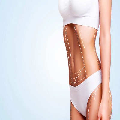 High-Definition Liposculpture in Dubai