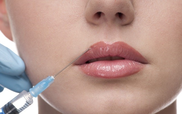 Lip Augmentation in Dubai