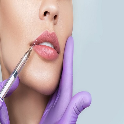 Lip Augmentation in Dubai