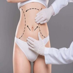 Bodytite Liposuction Cost in Dubai