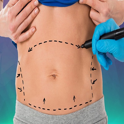 Bodytite Liposuction in Dubai