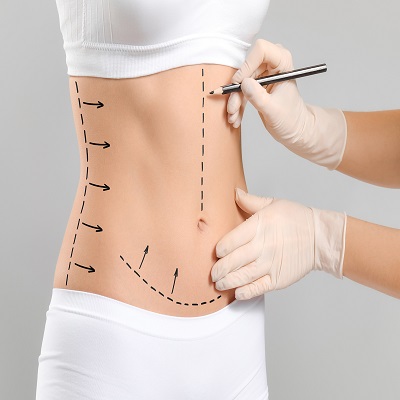 Bodytite Liposuction in Dubai