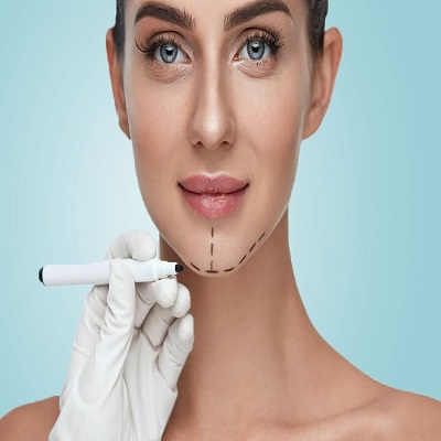 Chin Augmentation in Dubai