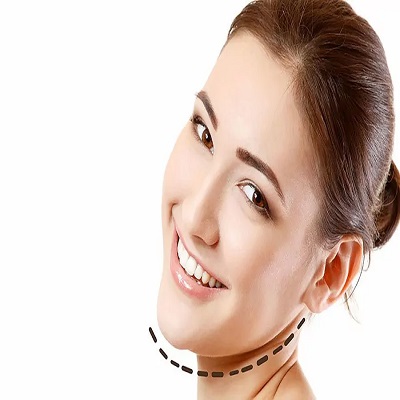 Chin Reduction in Dubai