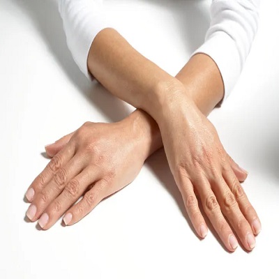 Hand Rejuvenation in Dubai