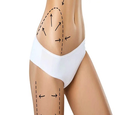 Vaser Quad Liposuction in Dubai