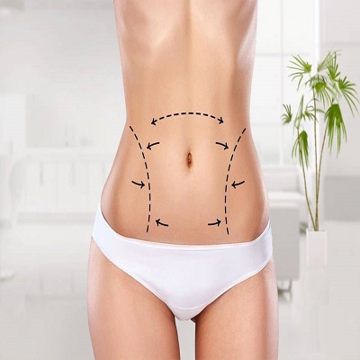 Vaser Quad Liposuction in Dubai