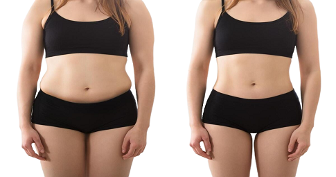 Waist Scuplting Before and After