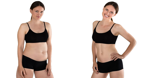 Waist Scuplting Before and After