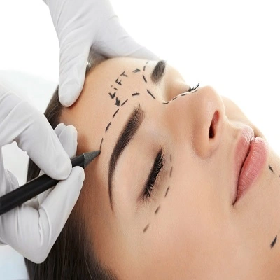 Brow Lift Surgery in Dubai