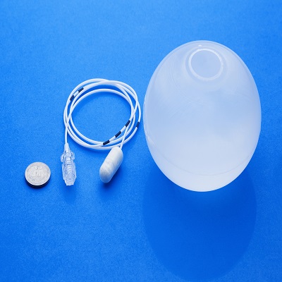 Gastric Balloon in Dubai