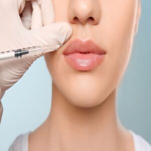 Lip Filler Injection Cost in Dubai