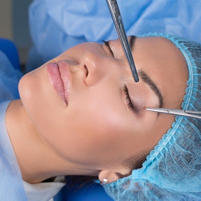 Blepharoplasty​ Surgery in Dubai