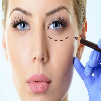 Blepharoplasty​ Surgery in Dubai