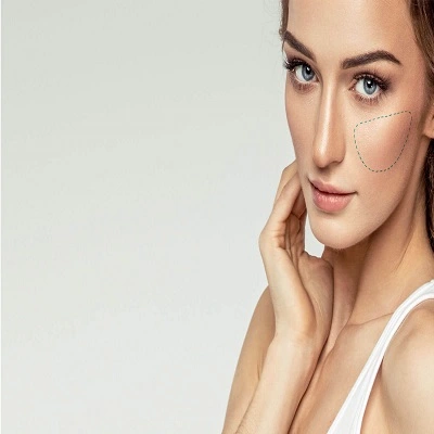 Cheek Augmentation in Dubai