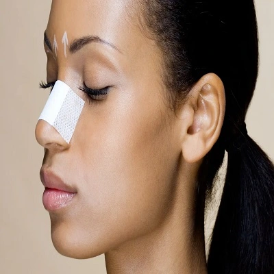 Closed Rhinoplasty in Dubai