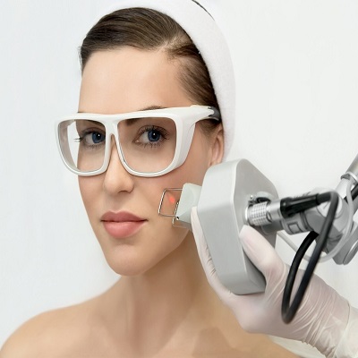 Laser hair bleaching in Dubai