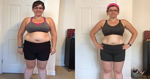 Post-weight loss surgery before and after